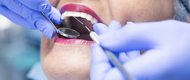 Best Emergency Treatment for Dental Infections or Abscesses in Machias, WA